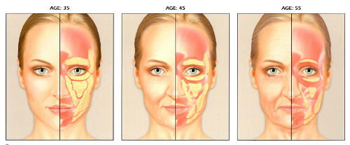 facial fat loss progression